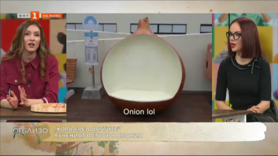 „Хора сред другите“: Островът в Япония, който издига на пиедестал… лука