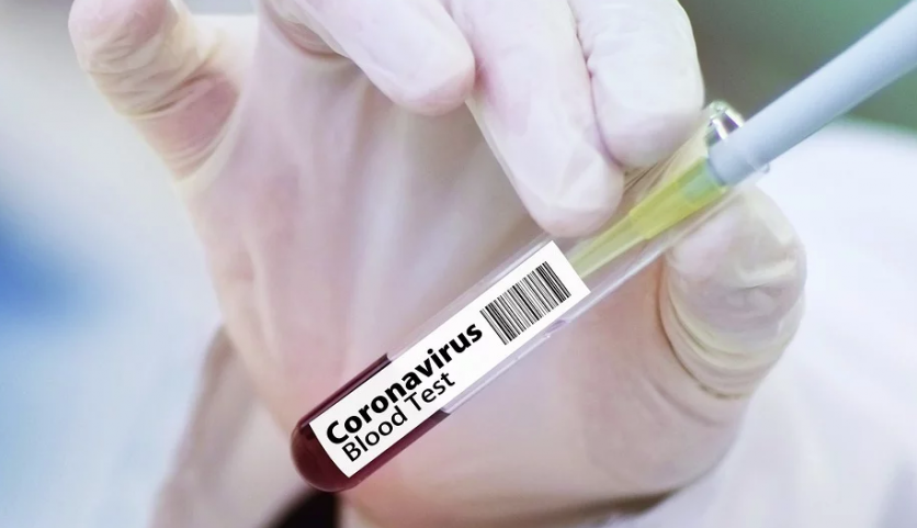 Coronavirus in Bulgaria: daily cases rise to 1,595