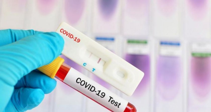 Изследването на преподаватели с антигенни тестове за COVID-19 започна в Пловдив