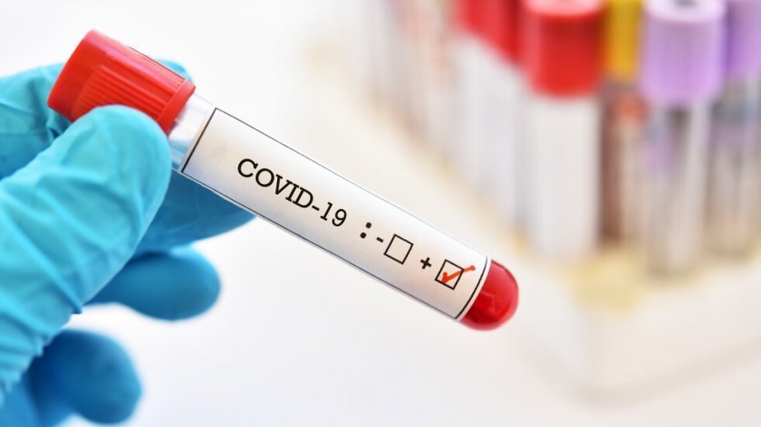 An outbreak of Covid-19 infections in a nursing home in Dobrich