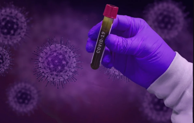 Coronavirus in Bulgaria: 189 new cases, total rises to 10312