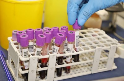 Coronavirus in Bulgaria: 4,955 new cases, positivity rate is at 13.6%