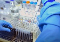 Coronavirus in Bulgaria: 96 new cases from 3402 PCR tests