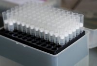 Coronavirus in Bulgaria: 86 new cases