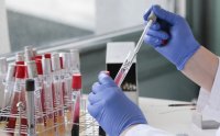 Coronavirus in Bulgaria: 462 new cases from 3,658 tests