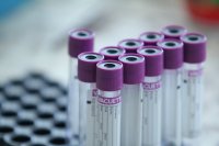 Coronavirus in Bulgaria: 81 new cases, test positivity rate is at 1,8%