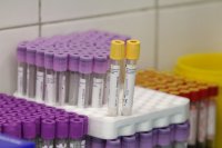 Coronavirus in Bulgaria: 2,192 new cases, positivity rate is 9.8%