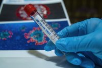 Coronavirus in Bulgaria: 2,181 new cases, positivity rate is 17%