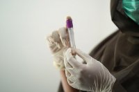 Health authorities in Bulgaria discuss measures to prevent possible spread of monkeypox